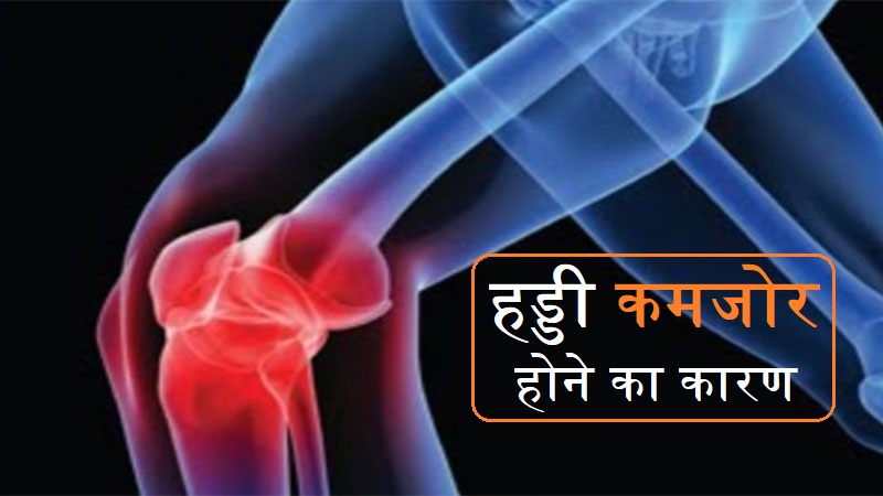 हड्डी कमजोर होने का कारण